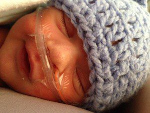 Asher after being switched to a Nasal Canula and Feeding Tube