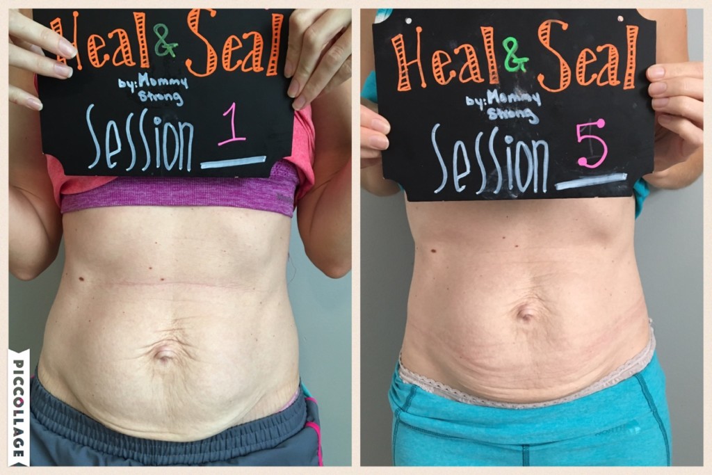 DAY #25 FLAT MOMMY TUMMY for the mommy pooch and diastasis recti